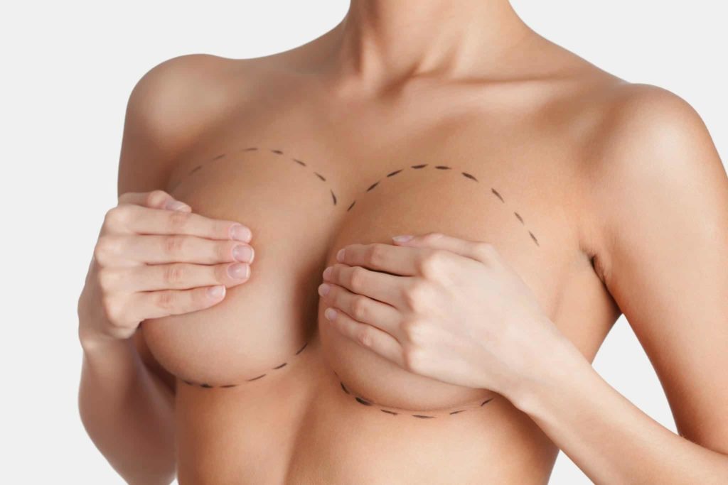 breast reduction candiates