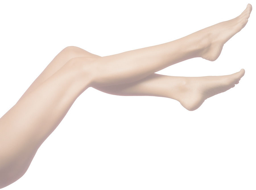 Varicose Vein Removal