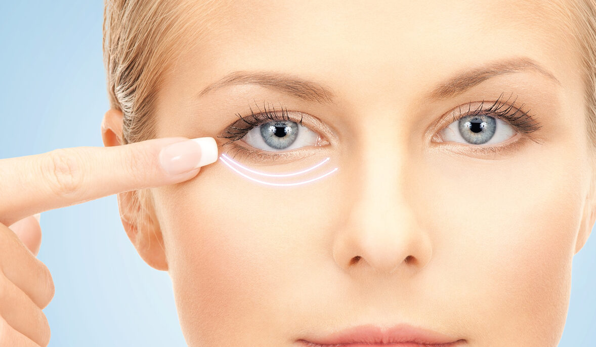 Laser Blepharoplasty Beverly Hills