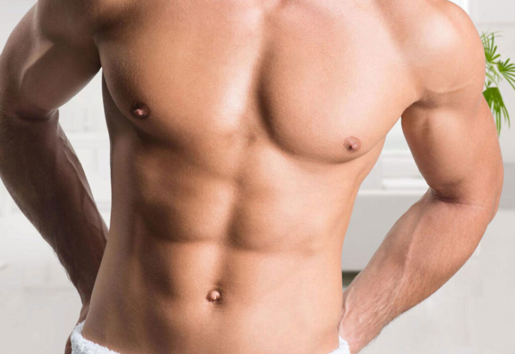 Gynecomastia