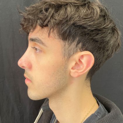 Rhinoplasty Before & After Patient #12093