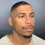 Rhinoplasty Before & After Patient #12096