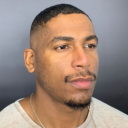 Rhinoplasty Before & After Patient #12096