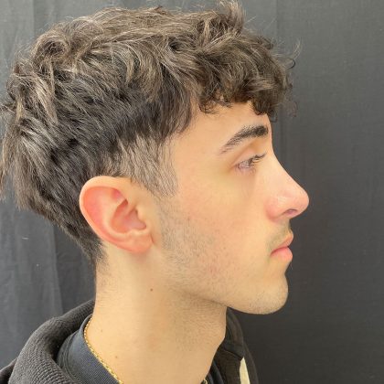 Rhinoplasty Before & After Patient #12093