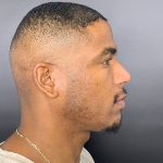Rhinoplasty Before & After Patient #12096